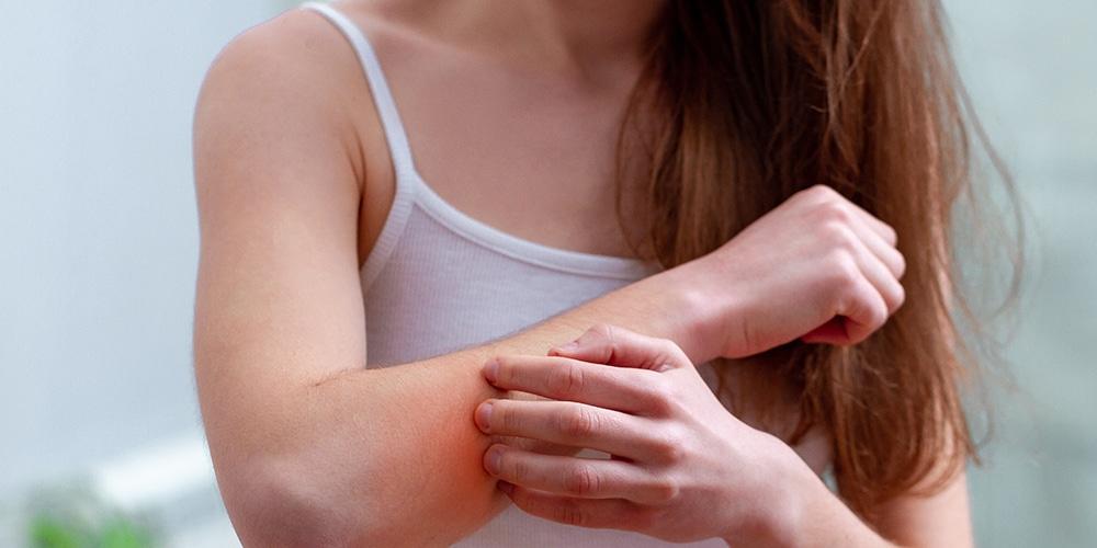 CBD și Psoriazisul: Cum te poate ajuta să scapi de mâncărime și "solzi"? 2 cbd pentru psoriazis tratament crema ulei mancarime